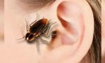 Tracakan v ušesu: simptomi in ekstrakcija