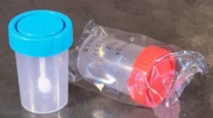 Analiza jajc na jajcih