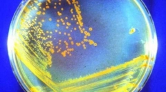 Nesmrtne živali, ki bodo preživele vse nas