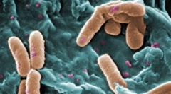 Kateri evkarioti se razlikujejo od prokariranja?