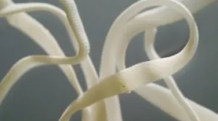 Kako nevarni črvi v ljudeh in njihovih simptomov