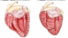 Kaj je hipertrofična kardiomiopatija pri mačkah in kaj je nevarno