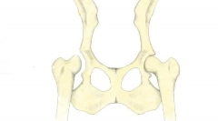 Prikazi kolka spojev pri psih: diagnosticiranje, zdravljenje in napovedi
