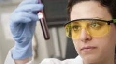 Kako se izvede krvni test na toksoplazmozi