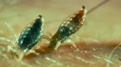 Kakšne ušesne ugrize izgledajo?