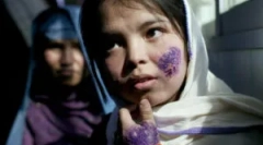 Kako biti okuženi z leishmeniki: simptomi in zdravljenje leishmaniosis