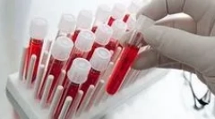 Kateri preskusi krvi na paraziti morajo iti?