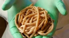 Kakšni črvi živijo v človeškem telesu