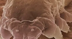 Demodex in značilnosti njenega preživetja