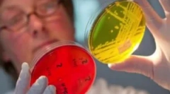 Zdravljenje enterobioze pri otrocih in odraslih