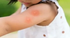 Najboljša orodja od komarjev za otroke