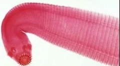 Najpogostejše vrste črvov pri ljudeh