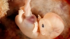 Ontogeneze in inherentne vzorce