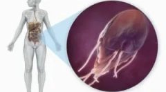 Moč in prehrana z giardijo