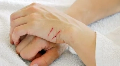 Zakaj se mačke borijo