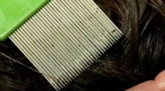 Postopek dokončanja za uši in nd