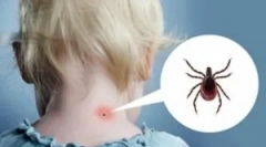 Reakcija telesa in klopi za ugriz