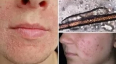 Analiza dostave na demodekozo