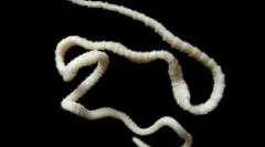 Širok lenthec pri ljudeh: zdravljenje in simptomi