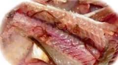 Simptomi in zdravljenje opisthorhoze