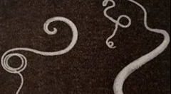 Simptomi in zdravljenje okužbe z močjo