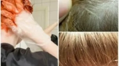 Ali ubija listrica lasje?