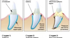 Homemade predator care - cattick čiščenje