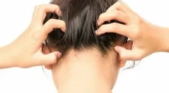 Vrste parazitskih žuželk v človekovi glavi