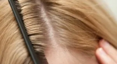 Razvrsti uši pri ljudeh