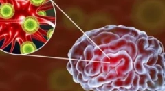 Virusni encefalitis možganov: vrsta in simptomi