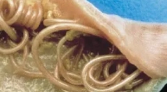 Notranji paraziti (endoparaziti)