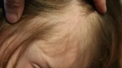 Uši in kratke hlače v lash v otroku