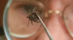 Človeška okužba z oznako-rojstvom encefalitisa